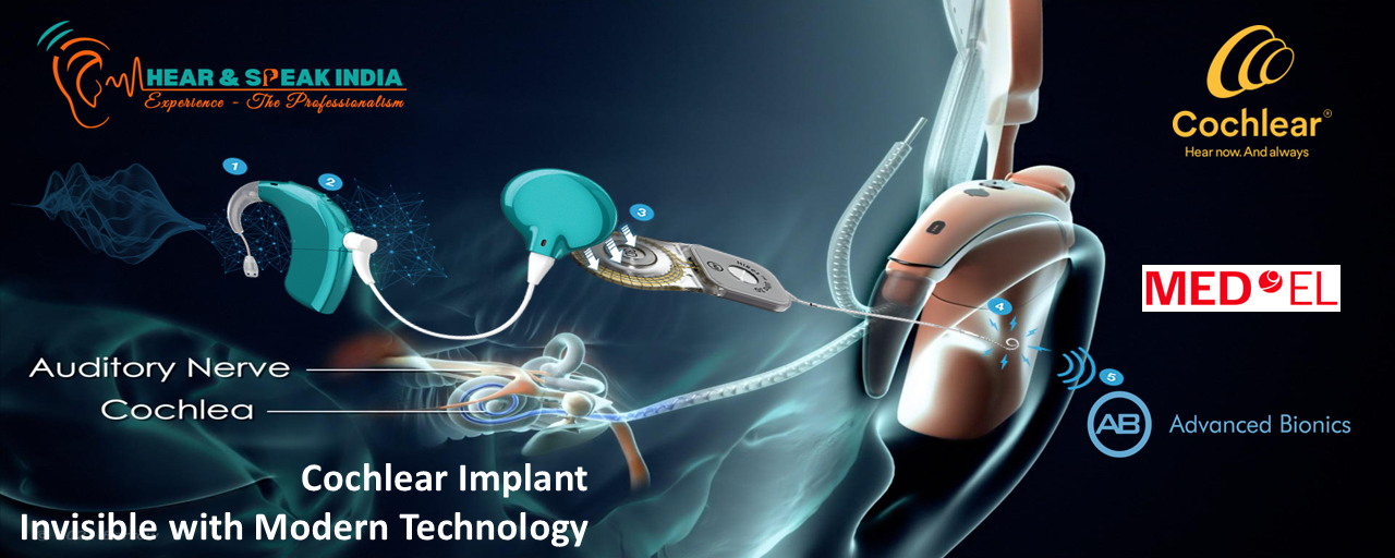 Speech Therapy Hearing Loss